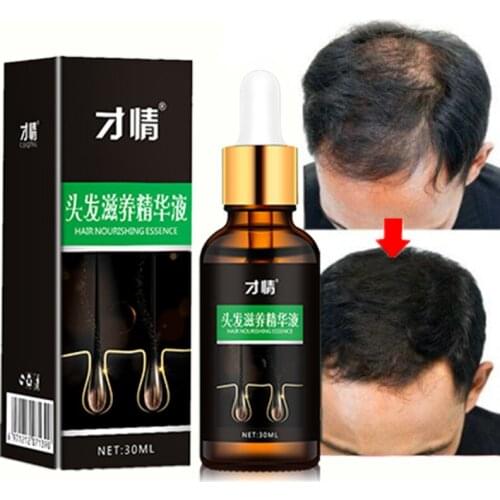 Hot Sale Hair Growth Essence Fast Powerful Hair Growth Essential Oil Hair Loss Treatment Help For hair Growth Hair Care