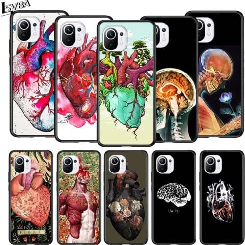Medical Human Organs Brain for Xiaomi Mi 11 10T Note10 Ultra 5G 9 9T SE 8 A3 A2 A1 6X Pro Play F1 Lite 5G Black Phone Case