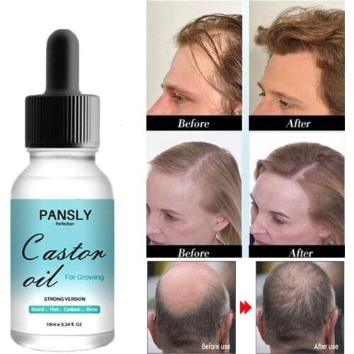 10ml Castor Oil Hair Growth Skin Massage Essential Oil Eyebrows Growth Prevent Skin Aging Castor Organic Extract