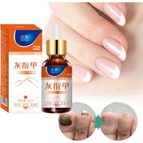 Onychomycosis Nail Repair Promote Regrow Nail Care Nail Essence Anti Infection Paronychia Leuconychia Toe Nails Removal Gel