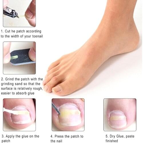 JETTING Skin Care Devices