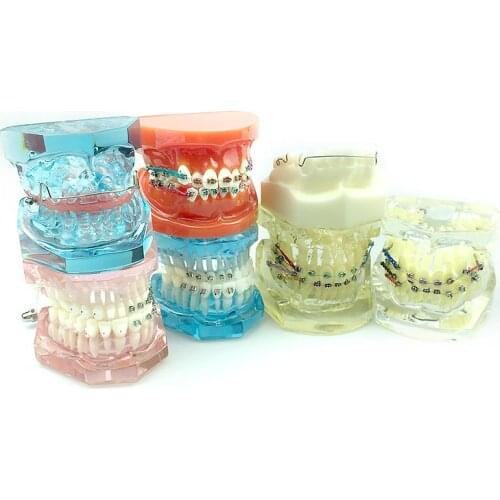 Dental Orthodontic Model Teeth Study Model Medical Science Disease Teaching Study Dental