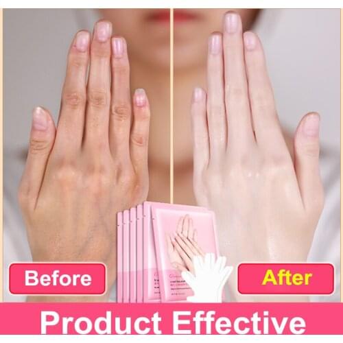 1Pair=2Pcs Snail Serum Extract Moisturizing Hand Mask Super Smoothing Whitening Exfoliating Mask Gloves Anti-Aging Hand Care