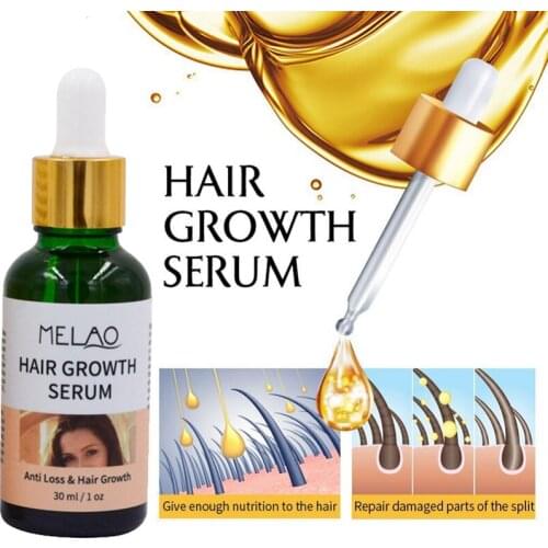 30ml Hair Treatment For Dry And Maintenance Hair Nutrition Essential Oil For Hair Growth Good Use Pure Natural Essence