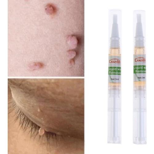 2Pcs 5 Days Skin Tag Remover Pen Natural Health Mole Nevus Wart Skin Tag Removal