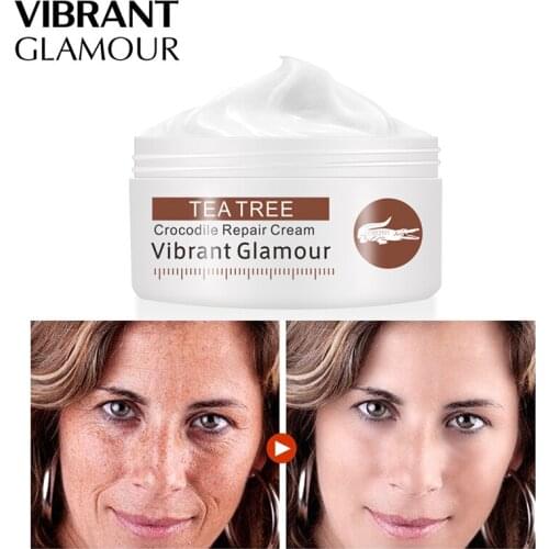 Crocodile Repair Face Cream Acne Scar Removal Whitening Anti-spots Acne Stretch Marks Treatment Dropshipping SMJ