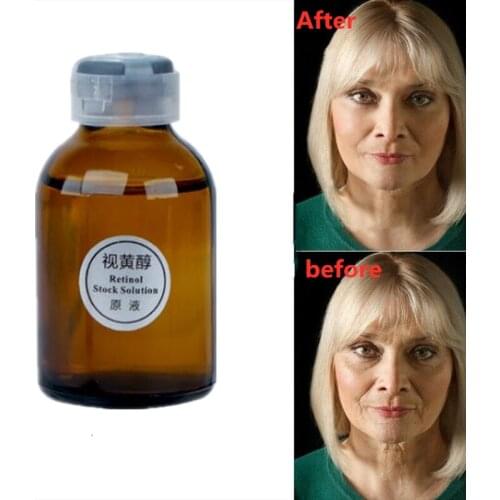 PURE RETINOL SERUM 5% HYALURONIC ACID RETINOL FACE CREAM 30ml Anti-aging Anti-wrinkle Exfoliate Skin Care Firming