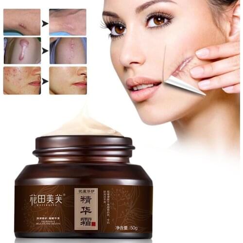 Powerful Whitening Freckle Cream Chinese Herbal Plant And Freckles Cream Dark Face 30g Whitening Cream Spots Remove Skin D8Z0