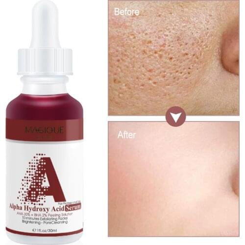 AHA 30% + BHA 2% Peeling Solution Face Serum Anti Ance Brighten Anti Aging Exfoliating Facial Serum 30ml Korean Face Skin Care