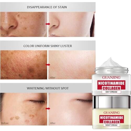 Niacinamide day night Cream Freckles face care day-night creams Moisturizing whitening cream day night cosmetics for face cream