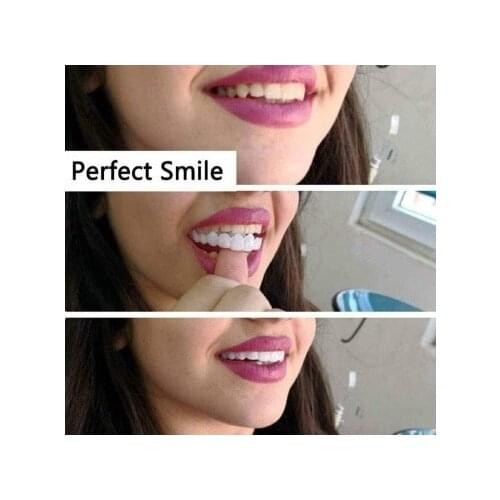3 set=6 pieces Simulation Braces,Mamum Instant Smile Comfort Fit Flex Cosmetic Teeth Denture Teeth Top Cosmetic Veneer