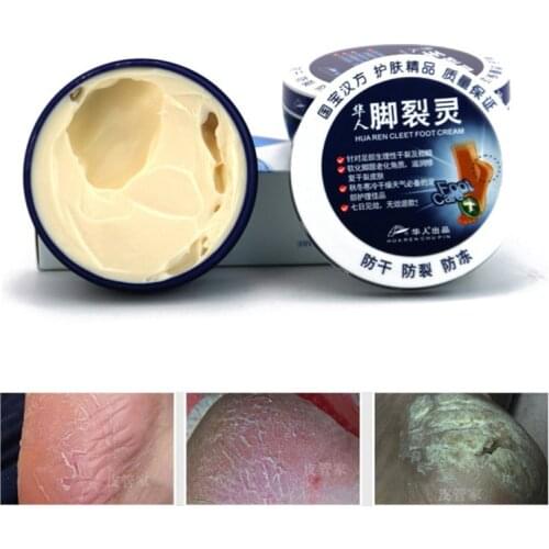 Winter Repair Chilblain Hand Foot Care Cream Anti Dry Chapping Crack Fissures Heal Exfoliatingb