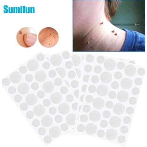 36/72/108Pcs Warts Remover Patch Skin Tags Remover Warts Treatment Cream Herbal Extract Foot Corn Plaster Acne Warts Stickers
