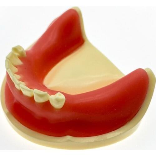 Dental Implant Practice For incision drilling Practice s Dental Study Teach Teeth Model