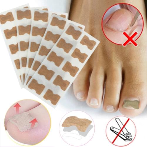 5pcs Non-Glue Ingrown Toenail Patch Set Correction Pedicure Tools for Toe Inlay Nail Corrector Patches Stickers Foot Care