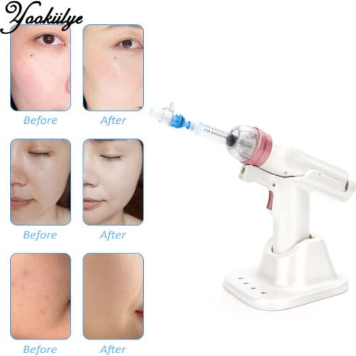 Hydrolifting Gun Korea Mesotherapy EZ Negative Pressure Meso gun Mesotherapy Hydrolifting Water Injector Microcrystal Injection