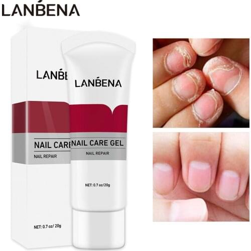 LANBENA Fungal Nail Treatment Gel Repair Damge Nail Remove Onychomycosis Paronychia Anti Infection Nail Removal Soften Nail Care