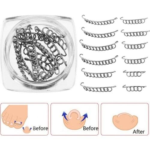 12pcs Ingrown Toe Nail Correction Wire Fixer Pedicure Paronychia Recover Toenails Corrector Foot Care Tool
