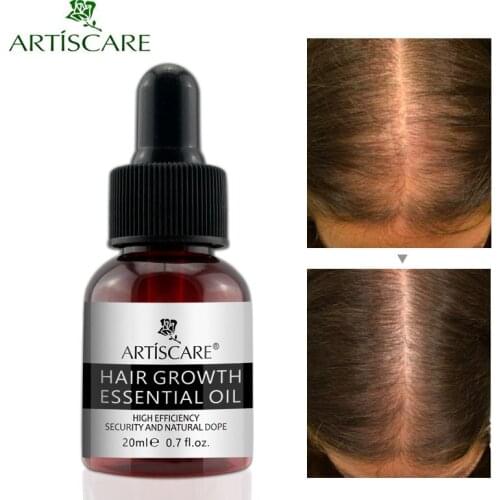 Hair Loss Product Hair Growth Essential Oil Nourishing Hair Lotion Anti Dry Damaged Repair Multi-functional Scalp Care TSLM1