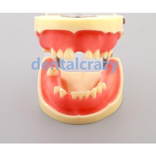 1pc Dental Implant Practice Model Dental Teeth Models M2002 tools models dentist