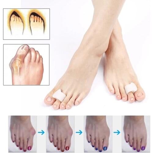 10pair Hallux Valgus Toes Ring Separador De Dedos Plantar Fasciitis Toes Silicone Bunion Gel Toe Separator Foot Care Pedicure