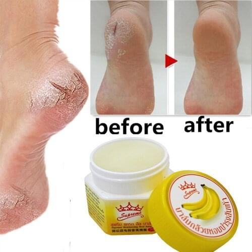 Heel Odor Treatment Anti Chapped Nourish Anti-Drying Crack Cream Skin Care Product Dead Skin Remover Banana Oil Repair