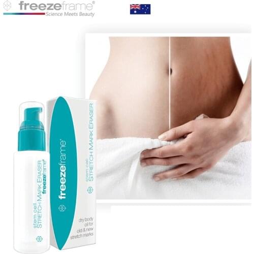 Original Australia Freezeframe Stem Cell Treatment of Stubborn Old New STRETCH MARK ERASER for Clearer Smoother Looking Skin