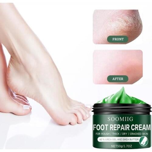 Hot Sale 15g/30g/50g SOOMIIG Pedicure Oil Professional Harmless Flat Base Foot Repair Pedicure Cream for Beauty