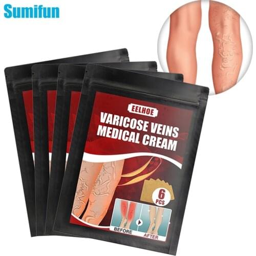 6pcs Varicose Veins Plaster Natural Herbal Extract Sticker Cure Varicosity Angiitis Remedy Pain Relief Patch Health Care C2429