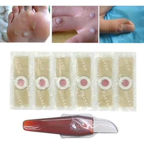 Painless Foot Care Foot Corn Remover Warts Thorn Removal Tool Callus w/ Knife