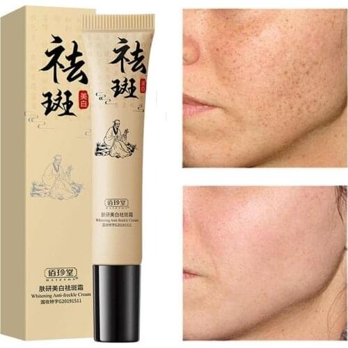 20g Effective Freckle Cream Remove Melasma Acne Spot Pigment Melanin Dark Spots Moisturizing Whitening Cream Skin Care