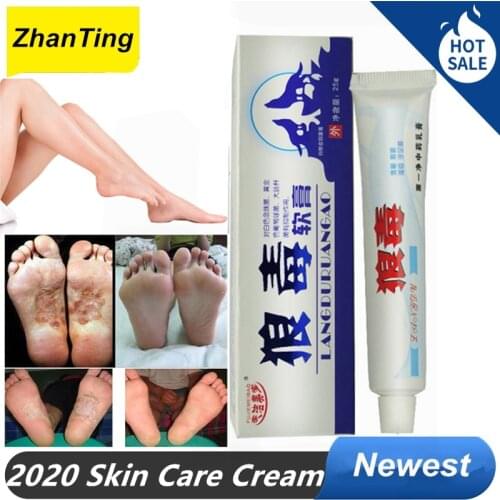 ZhanTing Natural Chinese Herbs Psoriasis Dermatitis Eczema Treatment Cream Onitment Anti Bacterial Skin Fungus Candida Albicans