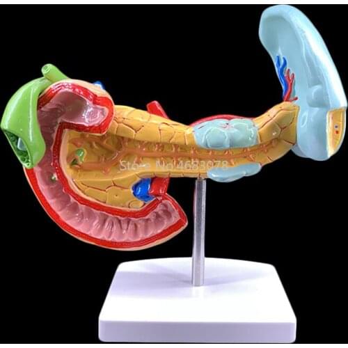 Life size human pathological changes pancreas and spleen gall bladder duodenum illness model