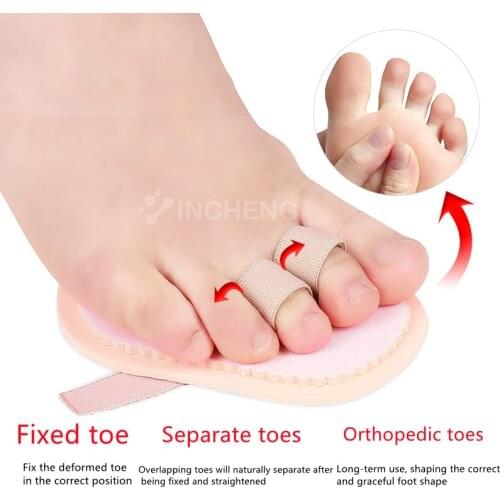 1PC Hammer Toe Straightener Bunion Protector Splint Overlap Toe Corrector Foot Care Tool Feet Bone Thumb Adjuster Toe Separator
