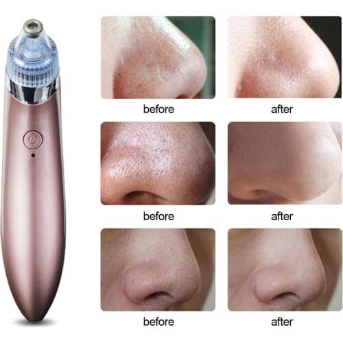 Blackhead Remover Face Deep Nose Cleaner T Zone Pore Acne Pimple Removal Vacuum Suction Facial Diamond Beauty Clean Skin Tool