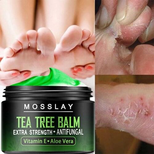 Mosslay Foot Creams