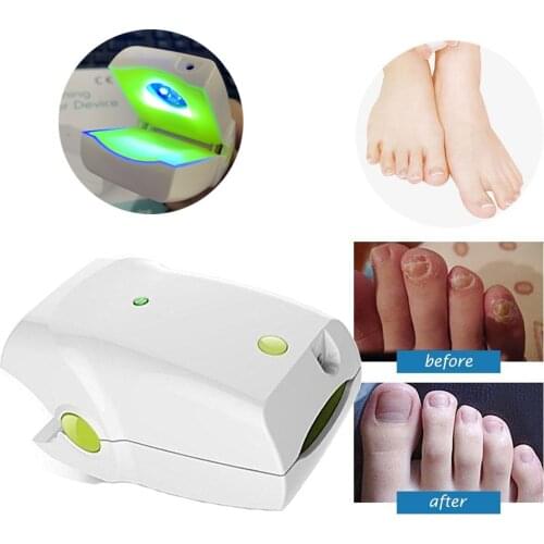 Cleaning Nail Fungus Laser Therapy Device Anti Toenail Fungal Onychomycosis Infection Cure EX Grey Nail Repair LLLT Cold Laser