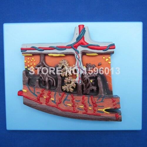 Enlarged Model of Placenta, Placental Tissue Model with umbilical Cord 3D Anatomy Teaching Model