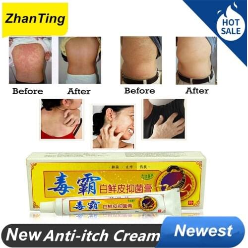 3 Pcs Psoriasis Herbal Antipruriti Ointment Cream Dermatitis Eczema Pruritus Cream Hot Psoriasis Cream Treatment Skin Care
