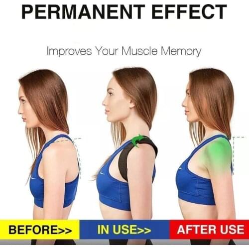 Medical Corset Posture Corrector De Postura Belt Back Support Belts Health Musculation Fitness Brace Shoulder Faja Velcro Hombre