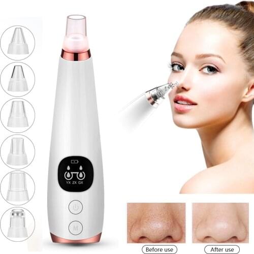 Blackhead Remover Skin Care Pore Vacuum Acne Pimple Removal Vacuum Suction Tool Facial Diamond Dermabrasion Machine Face Clean