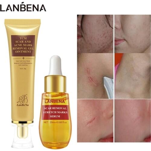 LANBENA Acne Scar Remove Cream Acne Treatment Serum Repair Stretch Marks Anti Acne Shrink Pores Blackhead Whitening Skin Care