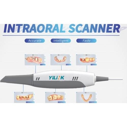 Dental Intraoral Intra oral 3D scanner——dental clinic Intraoral scanner CAD/CAM