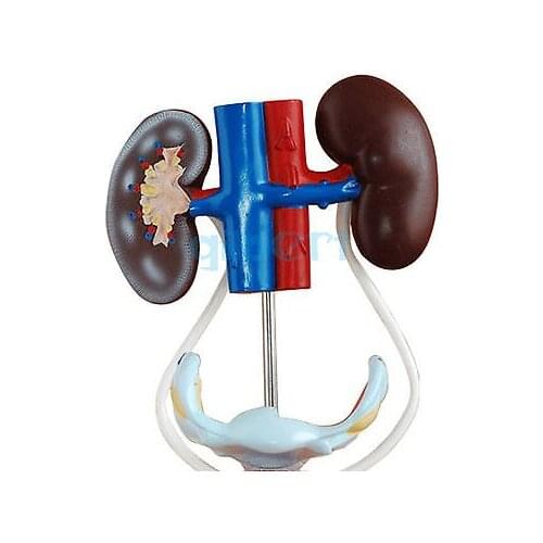 High quality Female Three Dimensional Urinary System Model With Artery Vein Kidney Medical