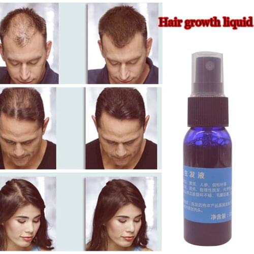 New brand Okenys 2016 yuda pilatory hair growth Product Liquid Fast Hair Growth hair loss Treatment 30ml/bottle anti gray hair