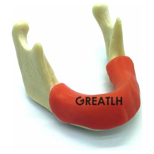 Dental Training Model Tool Dental Implant Practise Teeth Model Mandible Jaw with Soft Tissue with Gum
