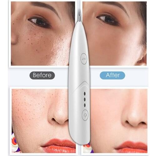 Plasma Freckle Remove Pen Mole Tattoo Remover Skin Tag Removal Spot Cleaner Wart Remover Machine Beauty Care tool