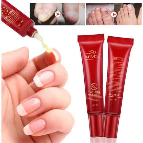 Nail Repair Cream Nourishing Herb Fingernail Care Treatment Striking Ointment WH998