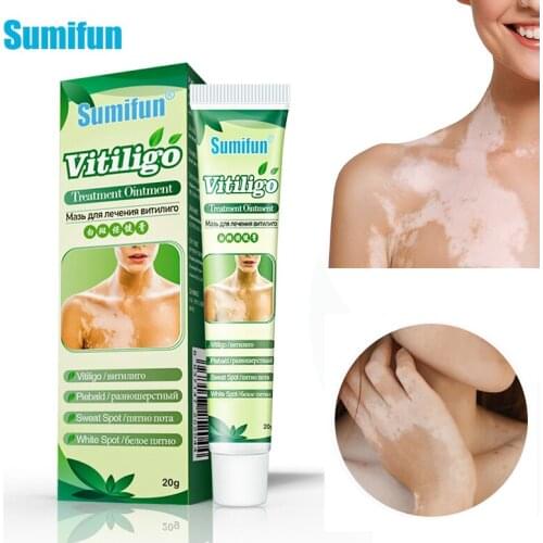 1/3/5pcs Vitiligo White Spot Mycosis Leukoplakia Treament Cream Antibacterial Cream Psoriasis Localized Vitiligo Ointment