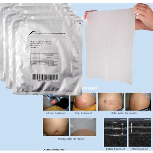 100% Effect New Arrival Lowest Price Anti freeze Membrane 27*30cm 34*42cm 28*28cm Antifreeze Membrane Cryo Pad for Cryolipolysis
